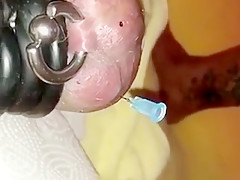 Hodennadelung extrem  needles in balls extreme