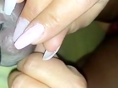 Hodennadelung extrem  needles in balls extreme