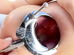 Anal Hotties, Scene 1