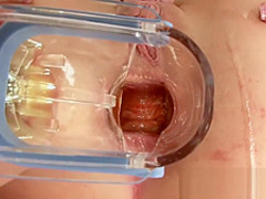 PervCity Gaping Anal Slut Chloe