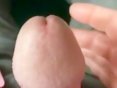 Swollen cock head