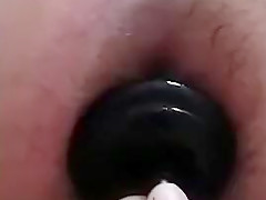 ass dilate
