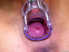 Aroused nurse cant hold back from playing with gyno equipment, because she wants to cum