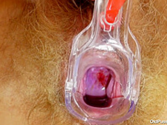 OldPussyExam - Slavena