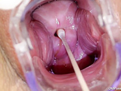 Robislava Pussy Exam