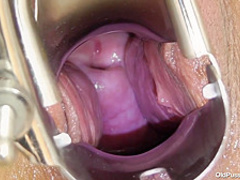 Robislava Pussy Exam