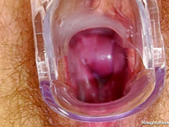 Naughty Head Nurse - Elaelena 1