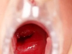 Naughty Head Nurse - Nora 1