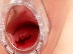 Naughty Head Nurse - Nora 1