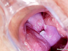 Naughty Head Nurse - Radana 1