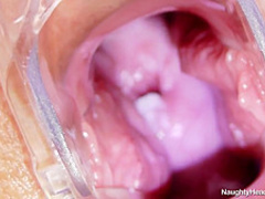 Naughty Head Nurse - Radana 1