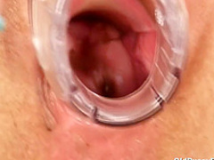 Naughty Head Nurse - Radima 1