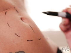 Plastic Surgeon Markup